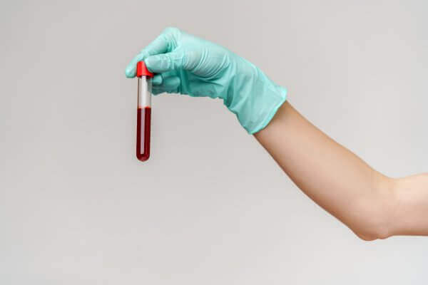 A gloved hand holding an auto-draft blood sample in a test tube against a light background.